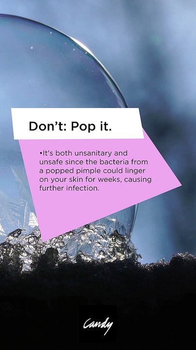 The Most Common Do's And Don'ts Of Treating Your Pimples