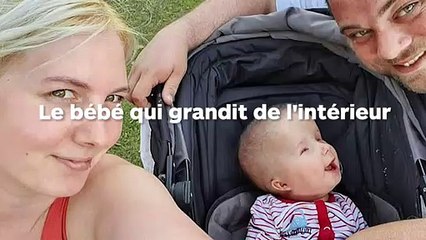 Un bébé qui ne grandit pas de l'extérieur mais ses organes grandissent à l'intérieur