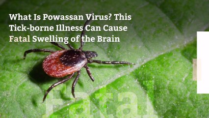 What Is Powassan Virus? This Tick-borne Illness Can Cause Fatal Swelling of the Brain