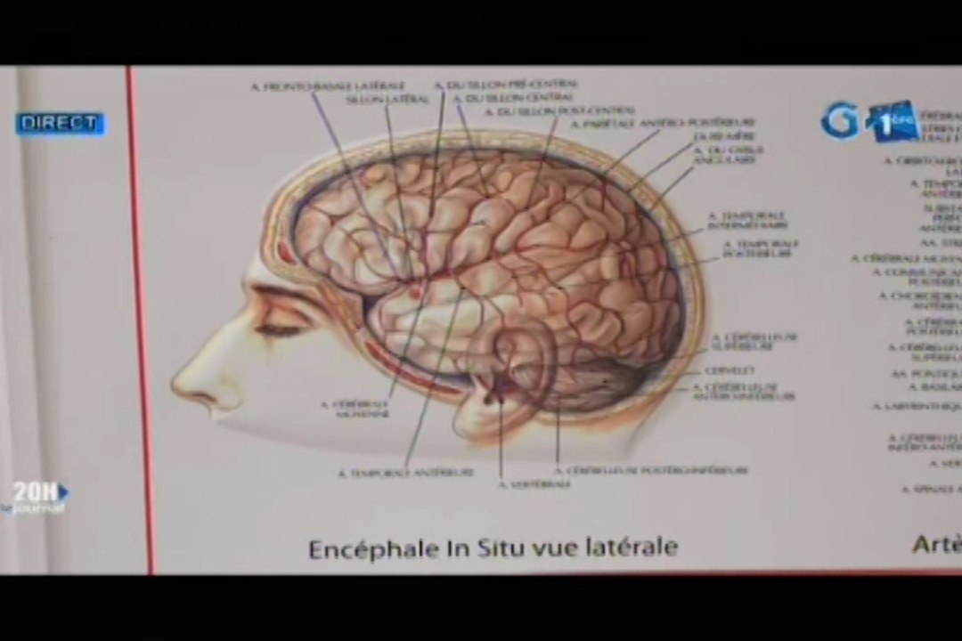 RTG/Célébration de la journée internationale de lutte contre les accidents vasculaires cérébraux