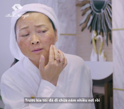 Bí quyết trị nám bằng phác đồ Melas Ruby tại Thẩm Mỹ Viện Bích Nguyệt