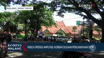 Korban Dugaan Penganiayaan Jalani Operasi Amputasi