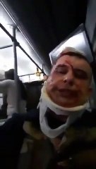 Uçak kazasında skandal: Yaralılar halk otobüsüyle taşındı