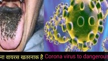 Coronavirus in China, coronavirus, coronavirus in usa, Who, coronavirus  India, coronavirus Japan, coronavirus Uk, coronavirus France, coronavirus urop, coronavirus Pakistan, coronavirus Brazil, coronavirus Africa,