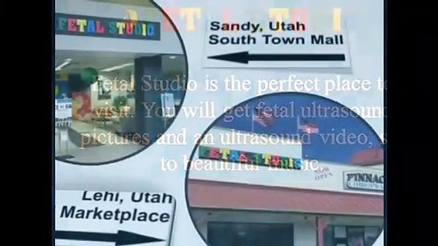 2D, 3D & 4D ULTRASOUND SCANS - FETAL STUDIO