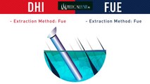 Which is better FUE or DHI