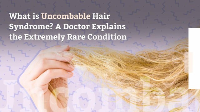 What is Uncombable Hair Syndrome? A Doctor Explains the Extremely Rare Condition