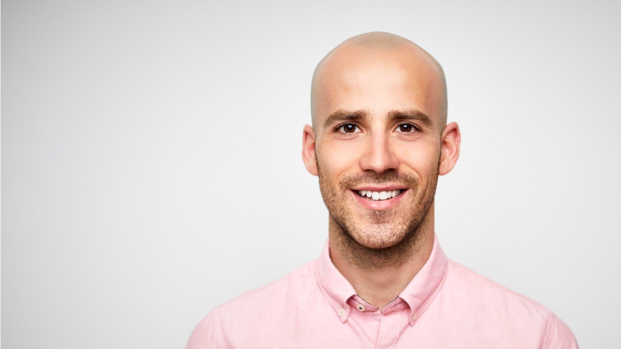 Why Do Men Go Bald?