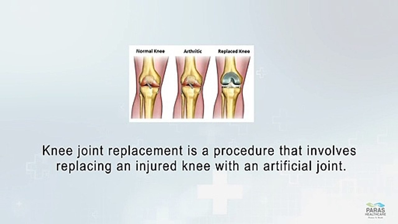 Knee Joint Replacement | Paras Hospitals