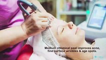 Why Should You Opt for Chemical Peels Procedure