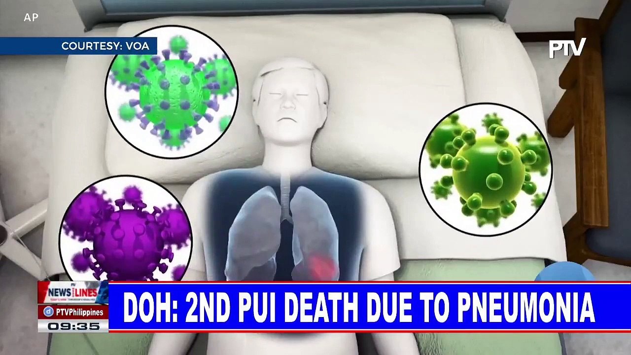 DOH: 2nd PUI death due to pneumonia