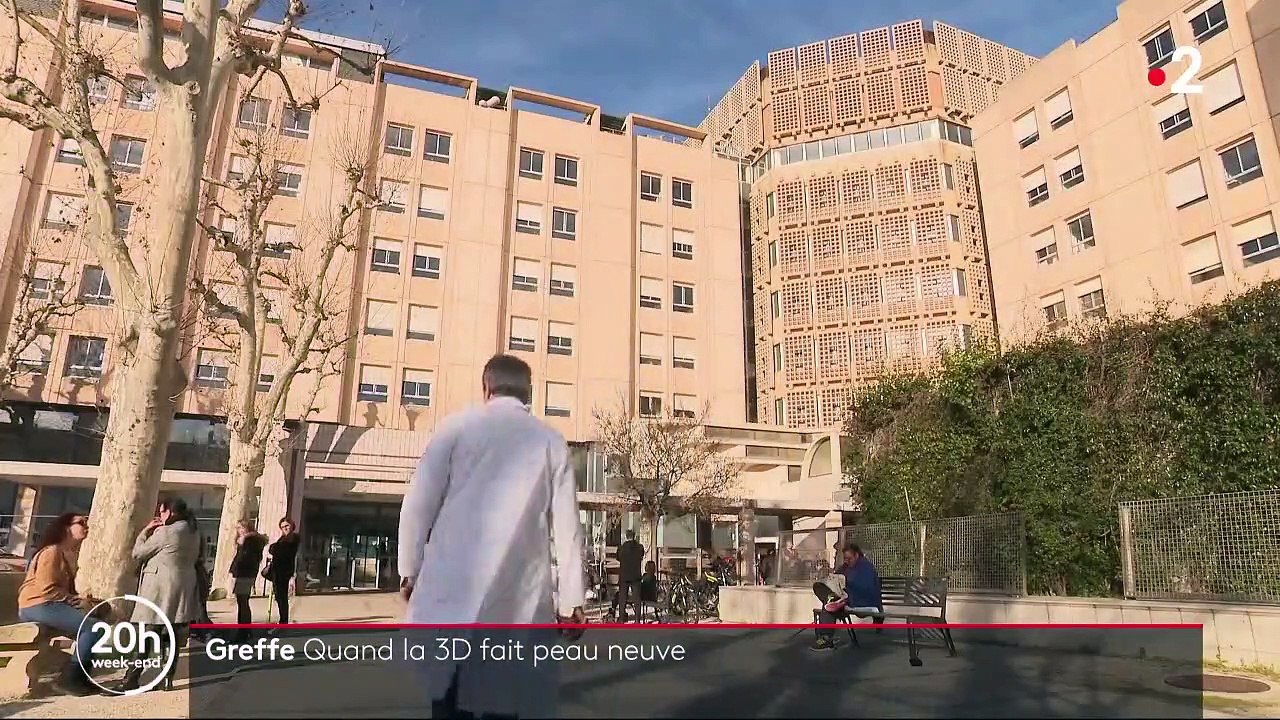 Santé : des greffons de peau fabriqués par une imprimante 3D