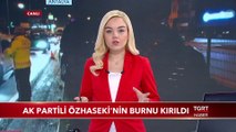 Mehmet Özhaseki Trafik Kazası Geçirdi, Burnu Kırıldı