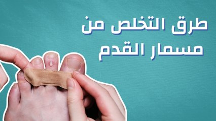 كيفية التخلص من مسمار القدم