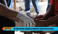 100 Penyandang Disabilitas Mendapat Bantuan Kaki Palsu