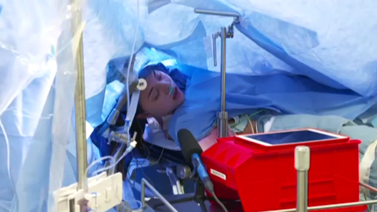 Hirn-OP bei vollem Bewusstsein live auf Facebook