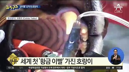 [핫플]세계 첫 ‘금이빨’ 갖게 된 호랑이