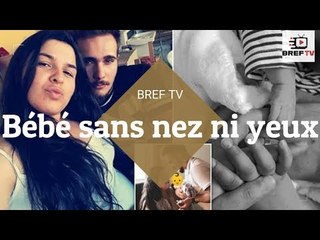 La colère d’une mère portugaise après la naissance d&#39;un bébé sans nez ni yeux