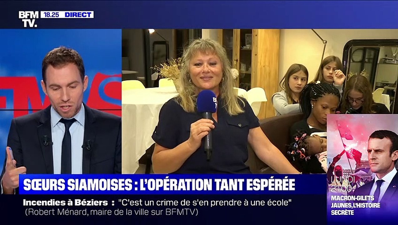 Soeurs siamoises: l'opération tant espérée - 01/11