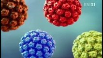 Inchiesta della RSI sul vaccino Gardasil per il Papilloma virus HPV