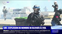 LBD: explosion du nombre de blessures à l'oeil depuis les gilets jaunes