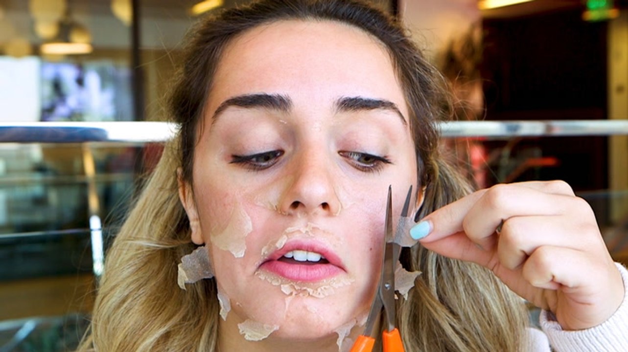 What it’s like to get a chemical peel for acne scars
