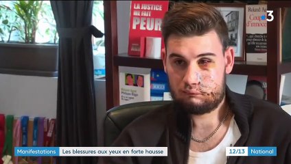 Manifestations : les blessures oculaires en forte hausse