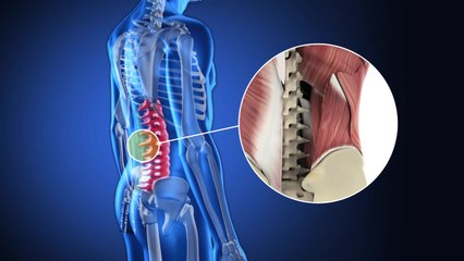 일교차 큰 요즘 허리 아픈 사람이 느는 이유는? / YTN