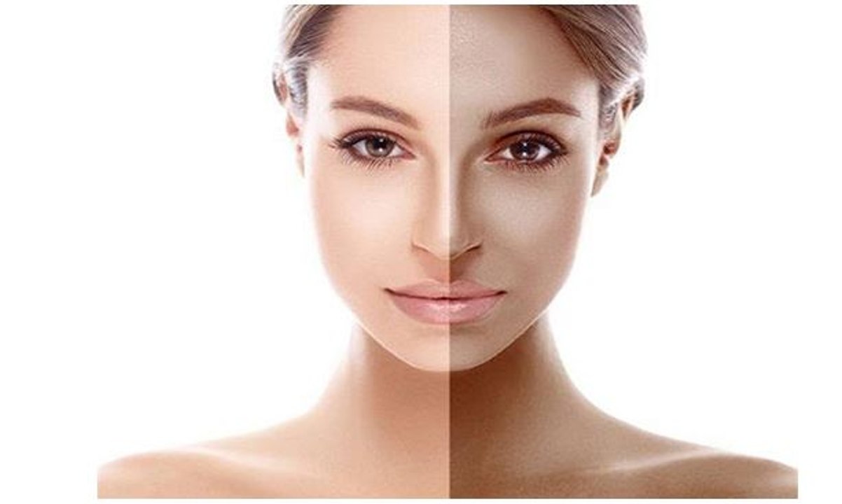 Diet to reduce skin pigmentation | इन खाने की चीजों से Skin होगी Dark | Boldsky