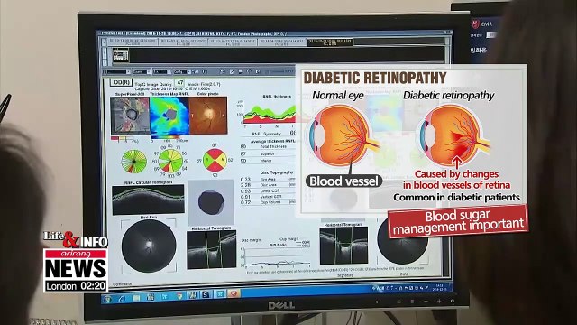 Blurred vision, age-related eye problems require regular check-ups