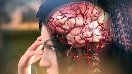 Se presenta un nuevo tratamiento para prevenir la migraña