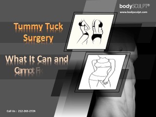 Tummy Tuck Surgery: What It Can and Cannot Fix