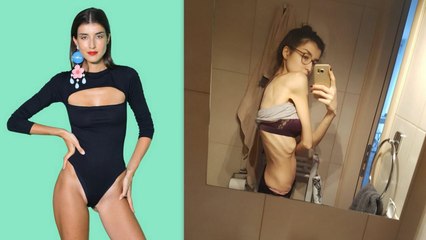 Μεσάνυχτα: Συγκλονίζει η πρώην παίκτρια του GNTM που είχε φτάσει 37 κιλά λόγω νευρικής ανορεξίας