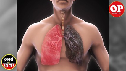 Poisonous Air Kills people in villages, not in metros