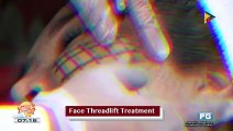 DERMAESTHETIQUE: Face threadlift treatment