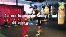 ¡Así era la cara de Becky G antes de operarse!: “¡Asusta!”