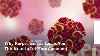 Why Herpes Isn't as Bad as You Think (and a Lot More Common)