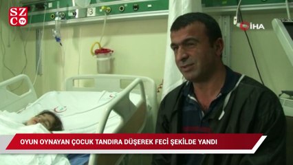 Oyun oynayan çocuk tandıra düşerek feci şekilde yandı
