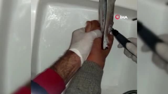 Parmağında sıkışan yüzüğü itfaiye çıkardı