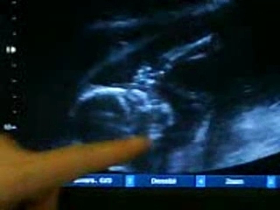 Liam 4eme echographie le 07.01.08