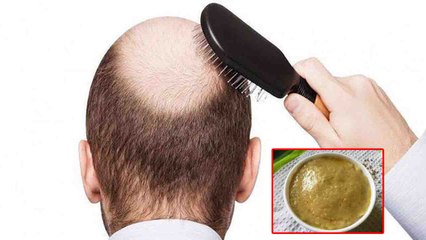 100% Effective Hair Regrowth Remedy for Men/Women | Boldsky