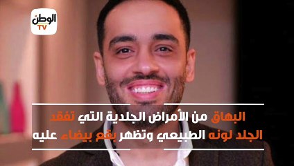 إليسا وتامر حسني  مشاهير يساندون رامي جمال بعد إعلان إصابته بالبهاق