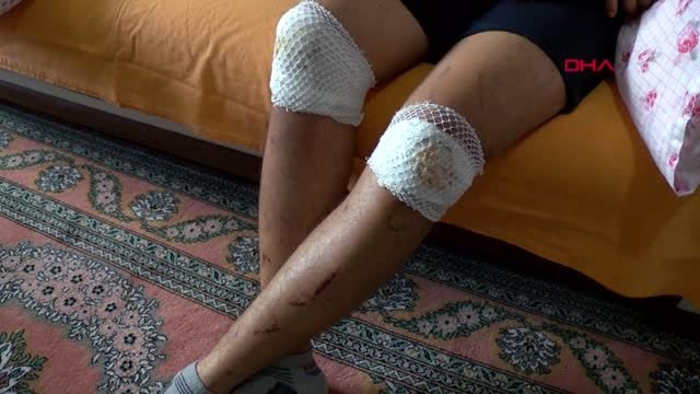 Denizli düştüğü kuyuda ölümden dönen genç, yaşadıklarını anlattı