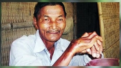 தூக்கம் என்றால் என்ன? உலகின் தூங்காத மனிதர்..!