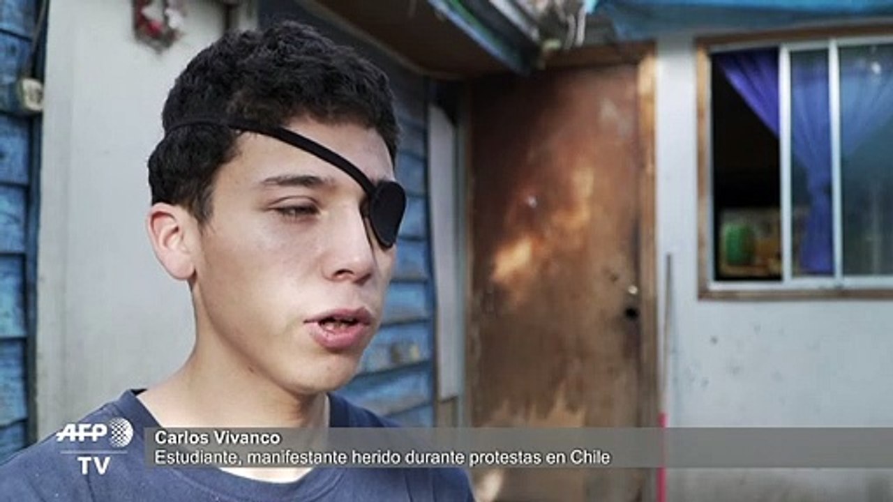 Lesiones oculares y ceguera, marcas indelebles de las protestas en Chile