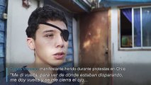 Lesiones oculares y ceguera, las marcas de las protestas en Chile