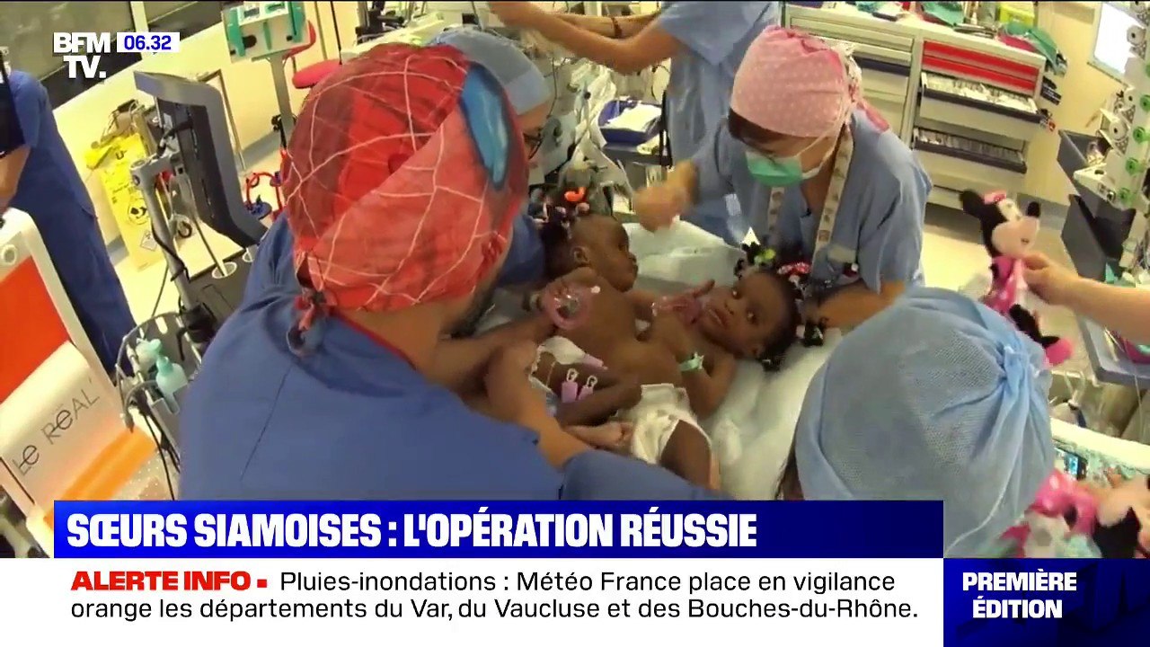 Opération réussie pour Bissie et Eyenga ! Les deux sœurs siamoises sont désormais des jumelles