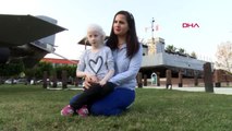 Adanalı albinolar güneş kremi desteği istiyor