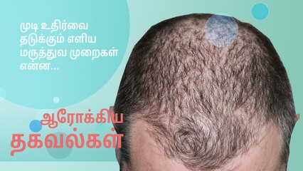 முடி உதிர்வை தடுக்கும் எளிய மருத்துவ முறைகள்..!