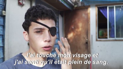 Eborgnés, ils portent les marques indélébiles des troubles au Chili